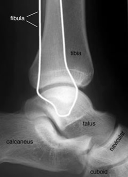 Ankle lateral labelled