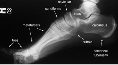 Foot lateral labelled