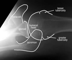 Elbow shoulder Axillary View labelled