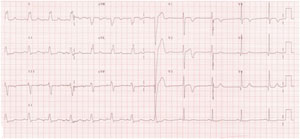 Wellen syndrome