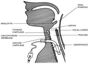 Tracheostomy anatomy