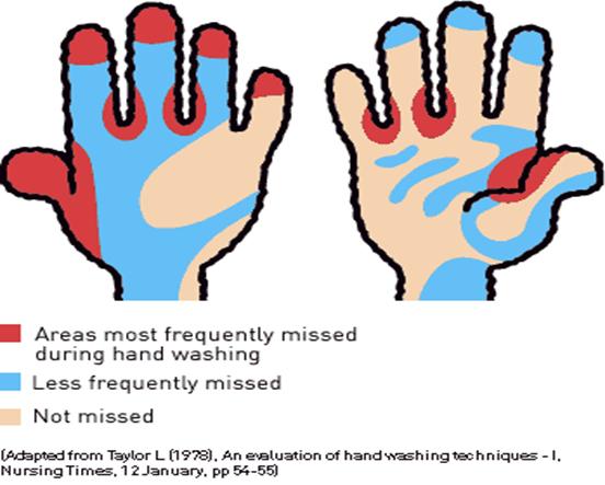 Areas Missed When Hand Washing