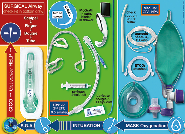 Airway Drawer 1 Mask Oxygenation
