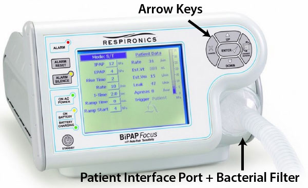 BiPAP Focus in CUH