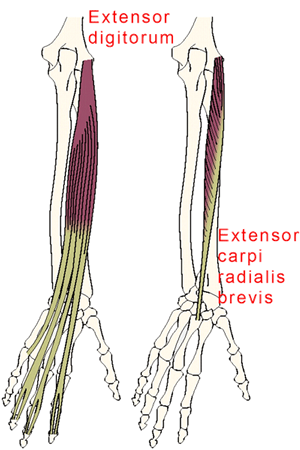 Common Extensor Origin at the elbow